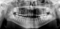 /album/fotogaleria-inicio/diagnostico-por-imagen-jpg/